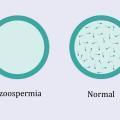 Azoospermia and normal 1