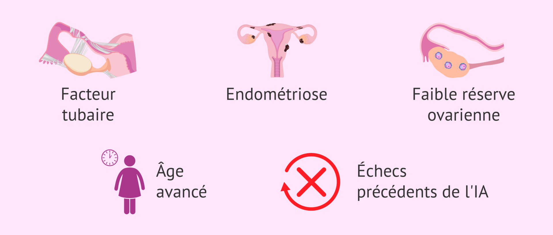 Causes infertilite feminine