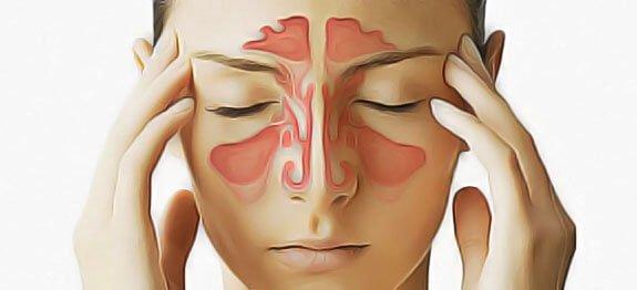 Remedes sinus enflammes